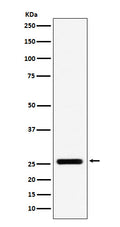 Western blot analysis of FADD expression in A431 cell lysate.