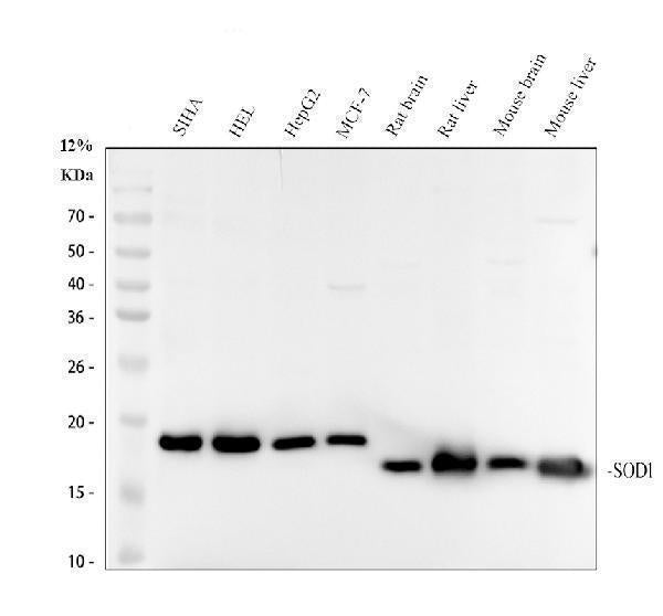 Anti-SOD1/Cu Zn Sod Rabbit Monoclonal Antibody