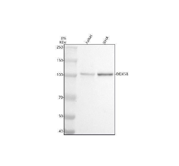 Anti-DDX58 Monoclonal Antibody