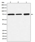 Western blot analysis of BTK expression in (1) Daudi cell lysate; (2) Ramos cell lysate; (3) K562 cell lysate.