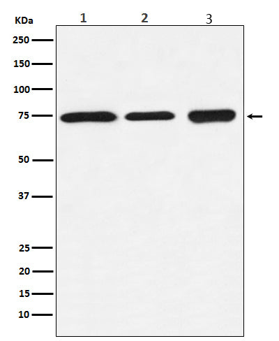 Western blot analysis of BTK expression in (1) Daudi cell lysate; (2) Ramos cell lysate; (3) K562 cell lysate.