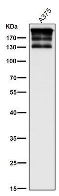 All lanes use the Antibody at 1:1K dilution for 1 hour at room temperature.