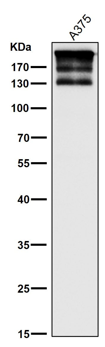 All lanes use the Antibody at 1:1K dilution for 1 hour at room temperature.