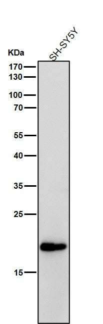 All lanes use the Antibody at 1:1K dilution for 1 hour at room temperature.