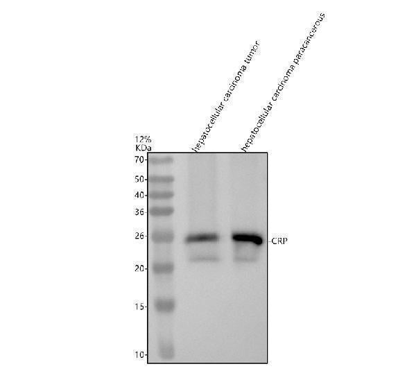 Anti-C Reactive Protein CRP Rabbit Monoclonal Antibody
