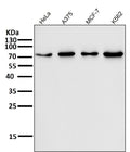 All lanes use the Antibody at 1:1K dilution for 1 hour at room temperature.