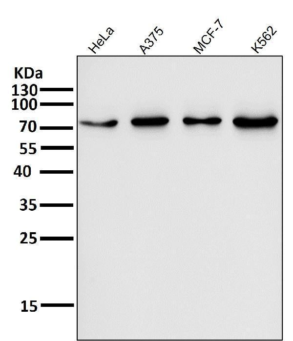 All lanes use the Antibody at 1:1K dilution for 1 hour at room temperature.