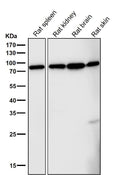 Anti-FoxO3a Rabbit Monoclonal Antibody