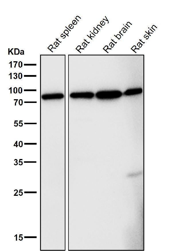 Anti-FoxO3a Rabbit Monoclonal Antibody
