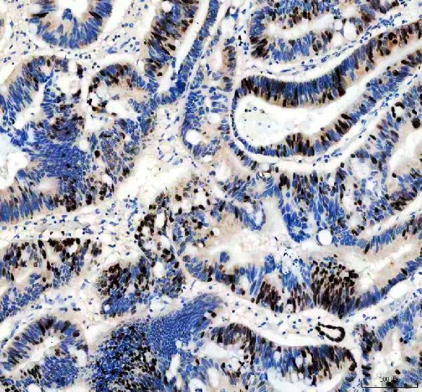 Anti-Ki67/MKI67 Rabbit Monoclonal Antibody