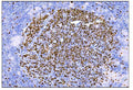 Anti-Ki67 Antibody  (monoclonal, 5E12)