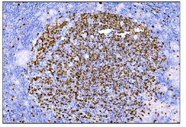 Anti-Ki67 Antibody  (monoclonal, 5E12)
