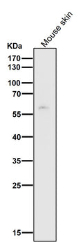 All lanes use the Antibody at 1:1K dilution for 1 hour at room temperature.