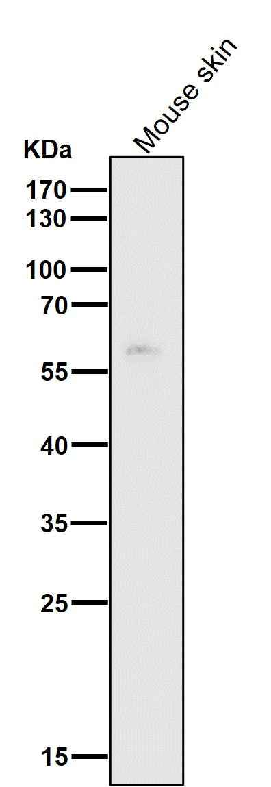 All lanes use the Antibody at 1:1K dilution for 1 hour at room temperature.