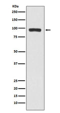 Western blot analysis of BCHE expression in A375 cell lysate.
