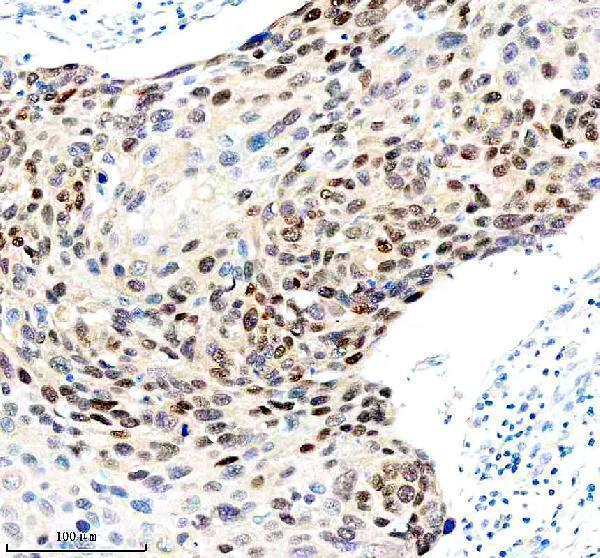Anti-FOXA1/Hnf 3 Alpha Rabbit Monoclonal Antibody