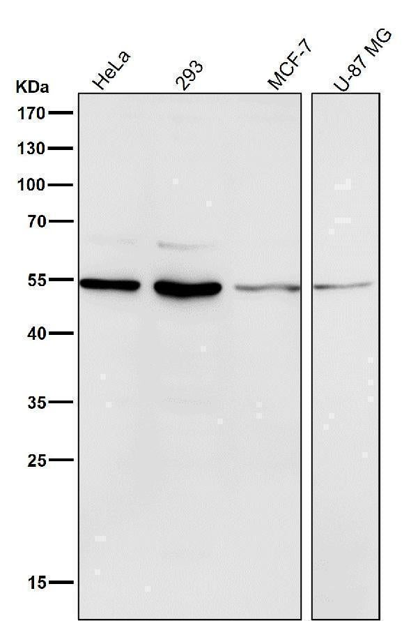 All lanes use the Antibody at 1:1K dilution for 1 hour at room temperature.