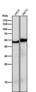 All lanes use the Antibody at 1:2K dilution for 1 hour at room temperature.