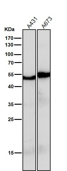 All lanes use the Antibody at 1:2K dilution for 1 hour at room temperature.