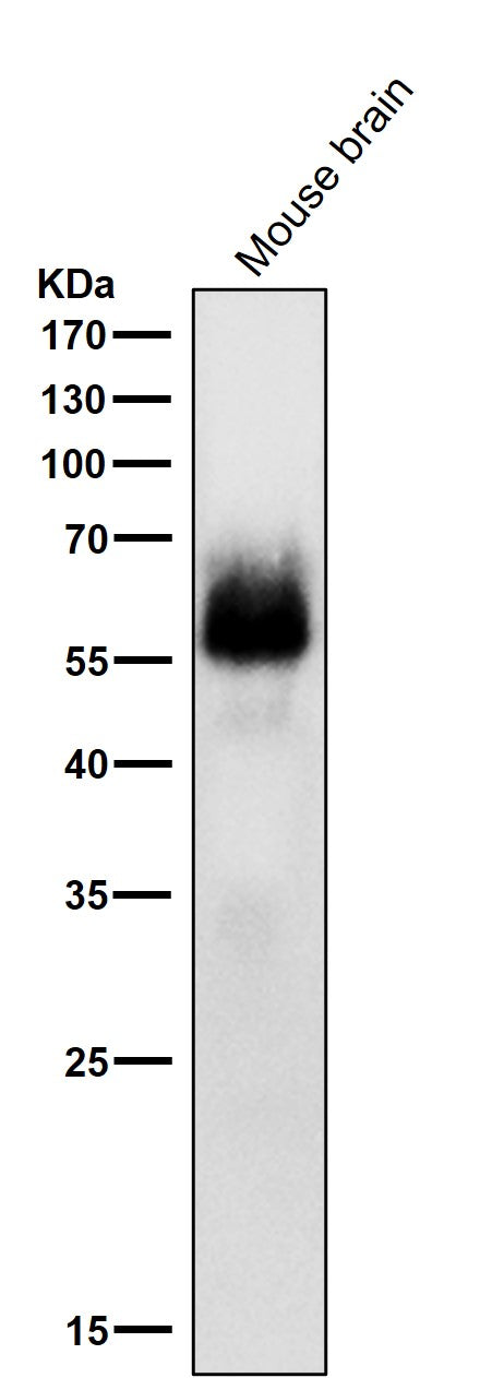 All lanes use the Antibody at 1:1k dilution for 1 hour at room temperature.