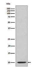 Western blot analysis of IP10 expression in IP10 recombinant protein lysate.