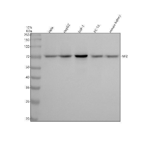 Anti-NF2 / Merlin Monoclonal Antibody