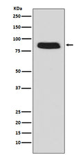 Western blot analysis of GCSF Receptor (CD114) expression in Caco-2 cell lysate.