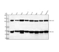Anti-NF-Kappa B (p105/p50) NFKB1 Rabbit Monoclonal Antibody