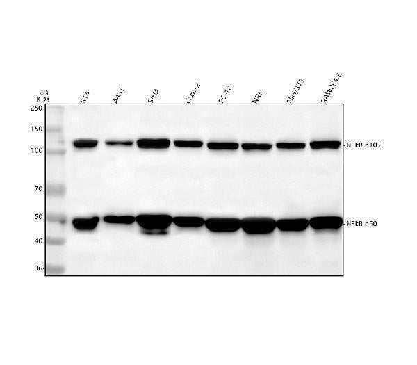 Anti-NF-Kappa B (p105/p50) NFKB1 Rabbit Monoclonal Antibody