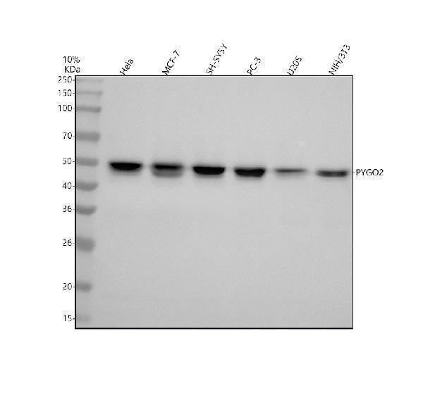 Anti-Pygopus 2 Rabbit Monoclonal Antibody