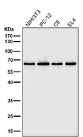 Anti-NF-Kappa B p65 RELA Rabbit Monoclonal Antibody