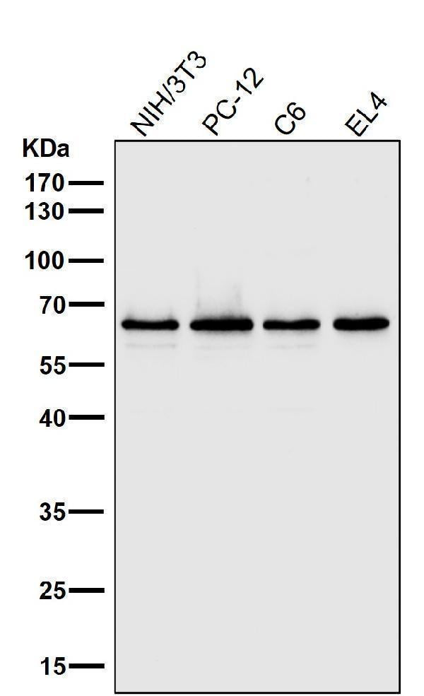 Anti-NF-Kappa B p65 RELA Rabbit Monoclonal Antibody