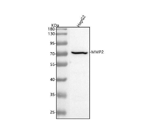 Anti-MMP2 Rabbit Monoclonal Antibody