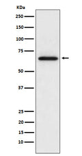 Western blot analysis of MMP2 expression in L6 cell lysate.