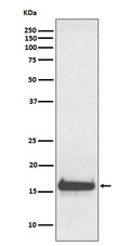 Western blot analysis of TTR expression in human serum lysate.