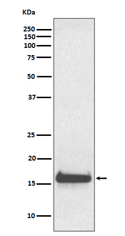Western blot analysis of TTR expression in human serum lysate.