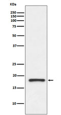 Western blot analysis of Prealbumin gamma expression in human fetal kidney lysate.