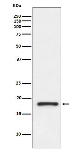 Western blot analysis of Prealbumin gamma expression in human fetal kidney lysate.