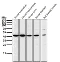 All lanes use the Antibody at 1:2K dilution for 1 hour at room temperature.