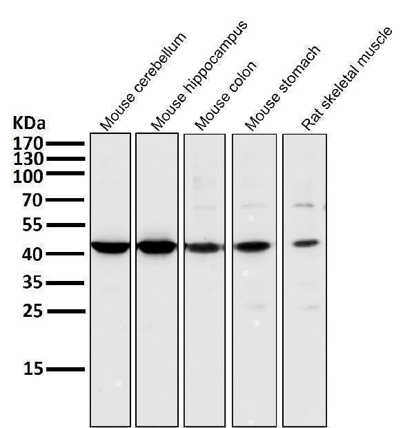 All lanes use the Antibody at 1:2K dilution for 1 hour at room temperature.