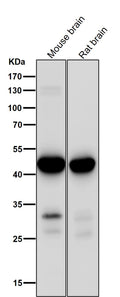 All lanes use the Antibody at 1:1K dilution for 1 hour at room temperature.
