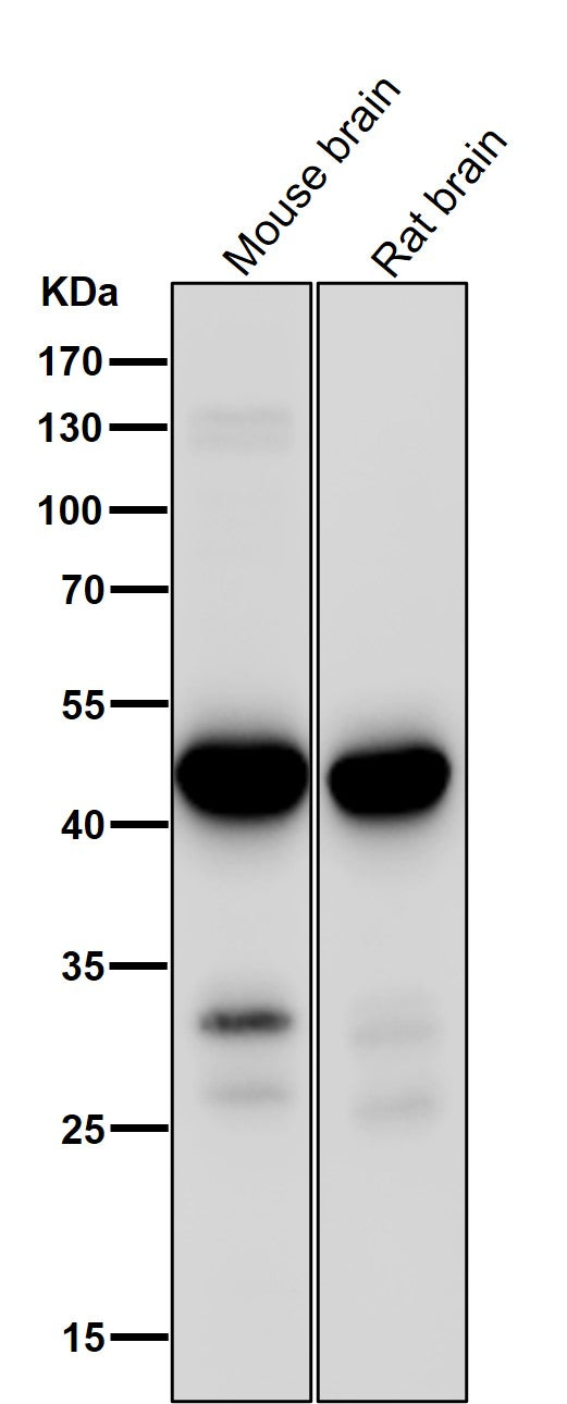 All lanes use the Antibody at 1:1K dilution for 1 hour at room temperature.