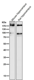 All lanes use the Antibody at 1:1K dilution for 1 hour at room temperature.