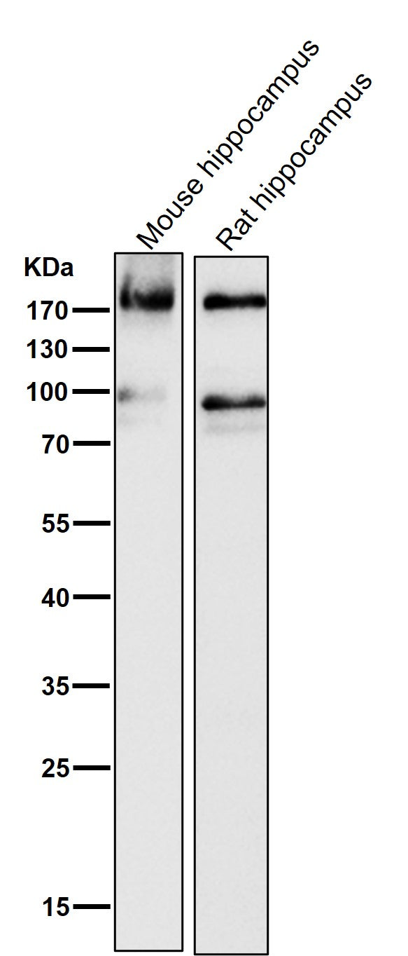 All lanes use the Antibody at 1:1K dilution for 1 hour at room temperature.