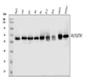 Anti-SQSTM1/p62 Antibody Picoband® (monoclonal, 3H11)