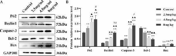 Anti-SQSTM1 / p62 Rabbit Monoclonal Antibody