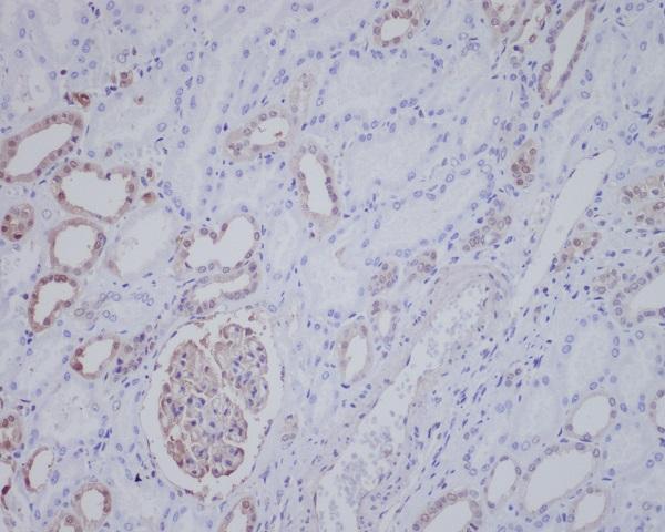 Immunohistochemical analysis of paraffin-embedded human kidney, using ALK Antibody.