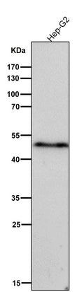 All lanes use the Antibody at 1:5K dilution for 1 hour at room temperature.