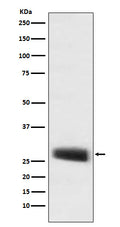 Western blot analysis of POMC expression in mouse pituitary lysate.