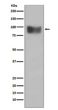 Western blot analysis of Interferon Receptor alpha expression in SH-SY5Y cell lysate.